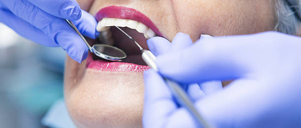 Best Emergency Care for Gum Disease in Larkspur, CA